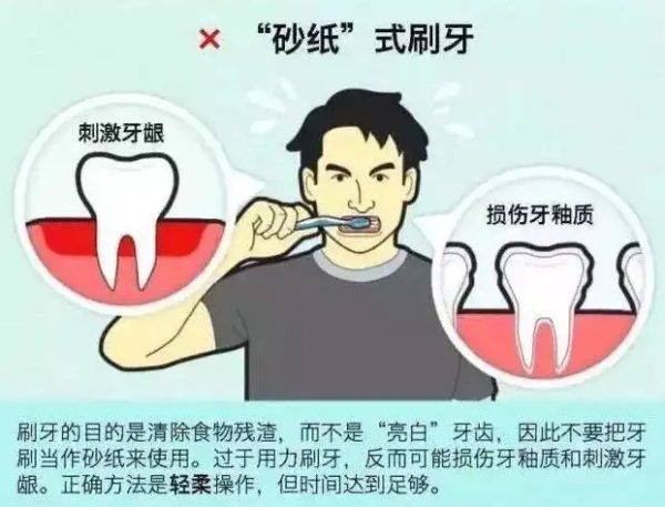去除牙结石的三种方法教程，深入了解去除牙结石的途径