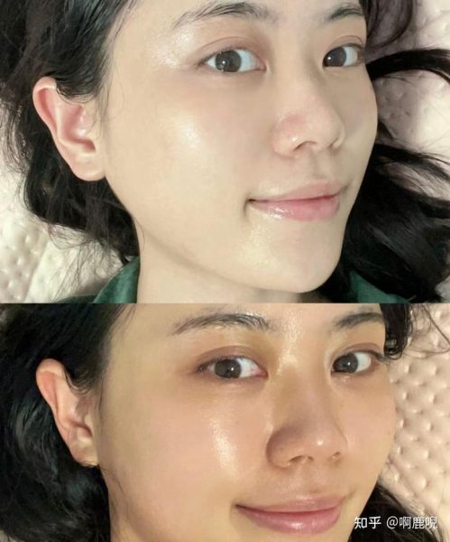 别小看皮肤瘙痒，这可能是癌症的“预警信号”！