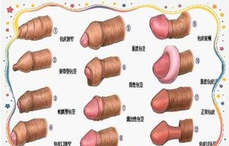 包皮过长一直翻开好不？医生揭秘惊人真相！