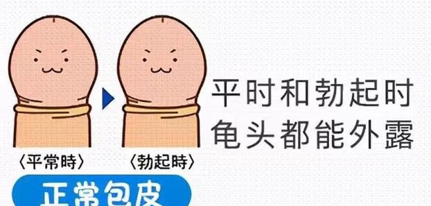 包皮过长一直翻开好不？医生揭秘惊人真相！