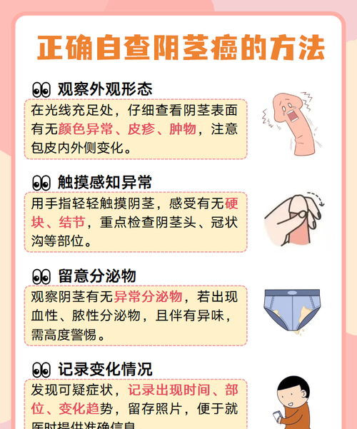 包皮过长不割会得阴茎癌吗