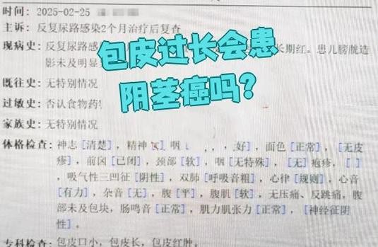 包皮过长不割会得阴茎癌吗