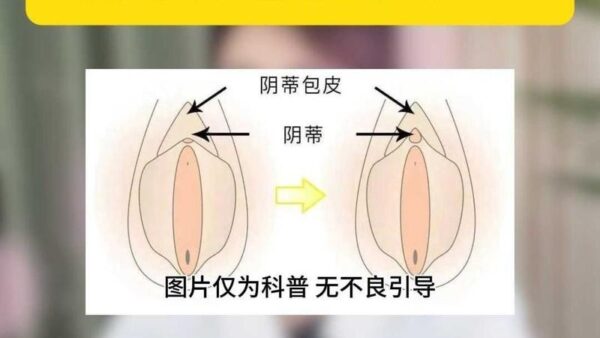 包皮过长女性能感觉到吗?揭秘两性关系中的敏感话题