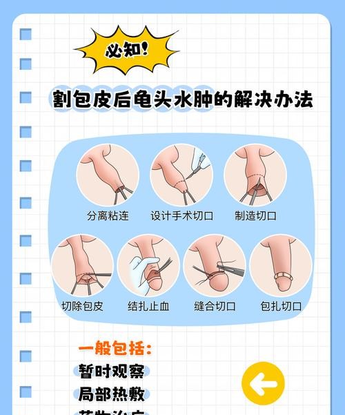 包皮过长术后肿正不正常?医生解答让你安心!