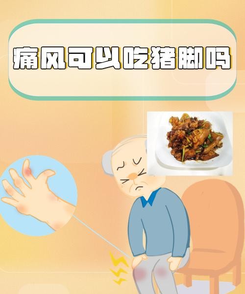 痛风患者必看！吃猪油真的会加重痛风吗？