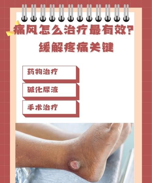 天津治疗痛风,这些方法让你告别疼痛!