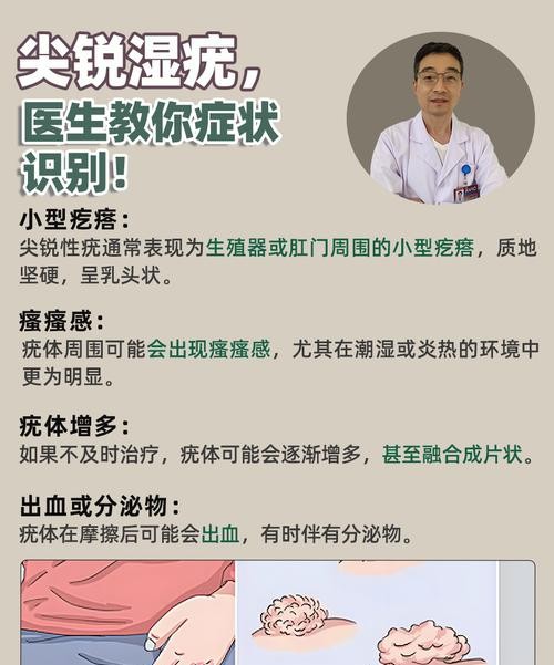尖锐湿疣真的疼痛吗?医生揭秘真相!