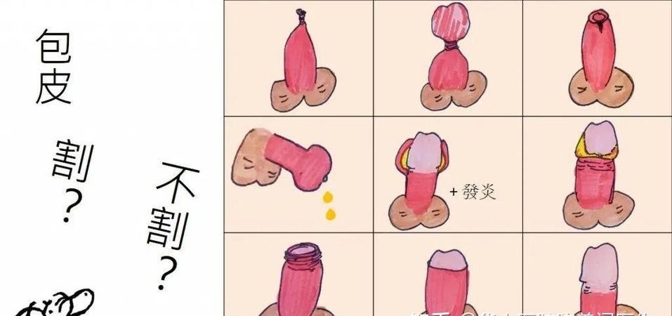 男性必看：怎么样才算男性包皮过长？3个标准自测法