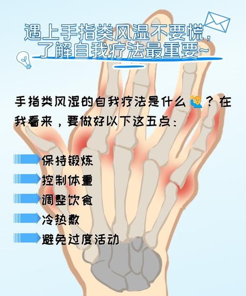 手指痛风快速消肿止痛方法