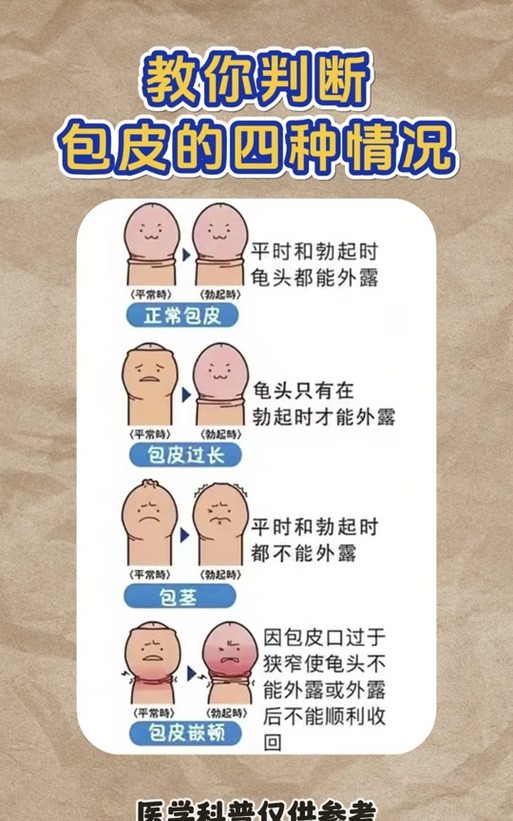 男孩子包皮怎样才算过长？医生教你3个自测方法