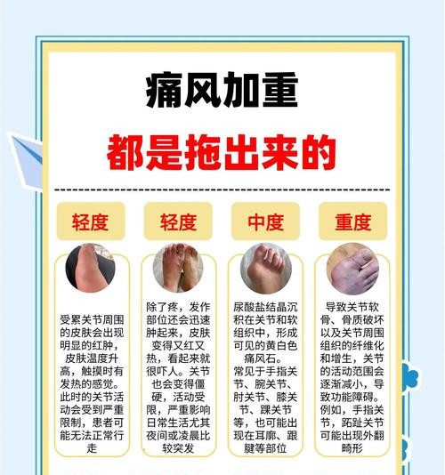 痛风结晶怎么快速溶解消除