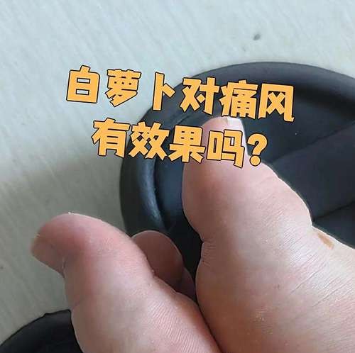 痛风患者必看!白萝卜这样吃,轻松告别疼痛困扰