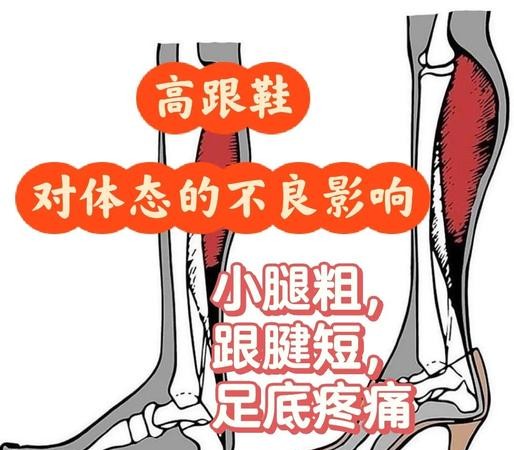 穿高跟鞋危害大揭秘！这5个后果你绝对想不到