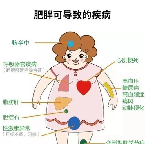 肥胖与痛风：揭秘体重超标如何悄悄引发关节剧痛