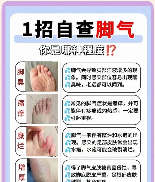 脚气不治会引发哪些严重后果