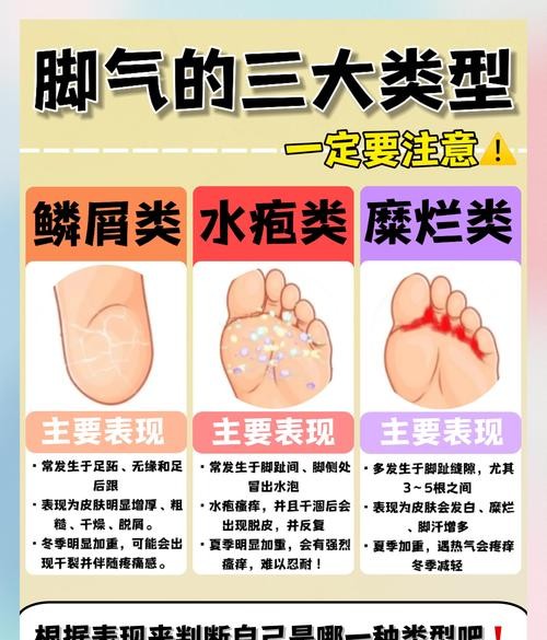 脚气不治会引发哪些严重后果