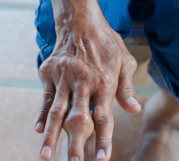 青医痛风专科医院预约挂号流程