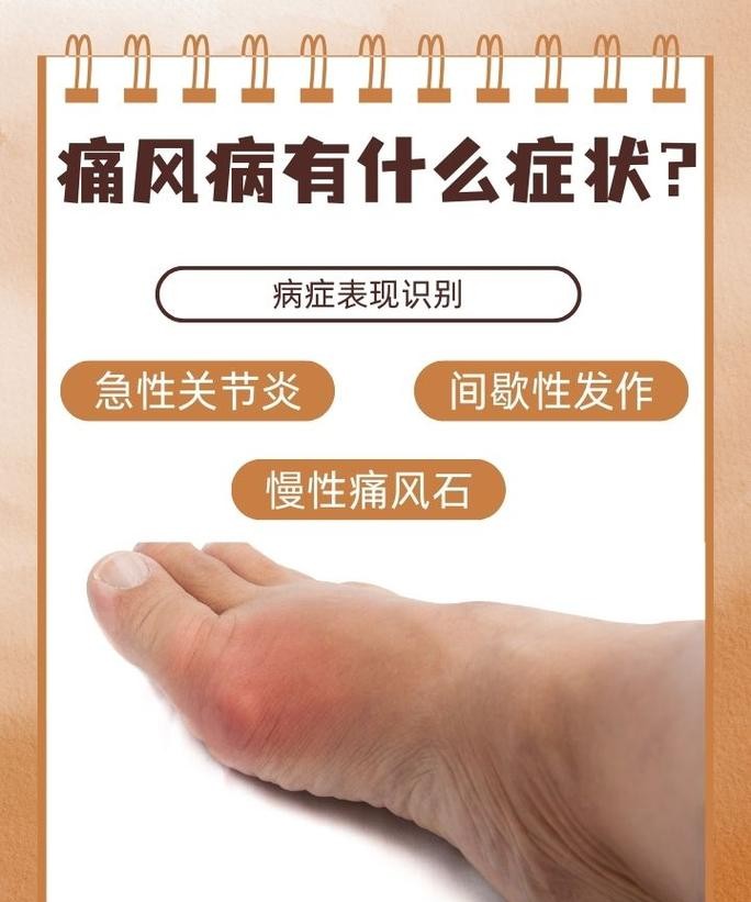 青医痛风专科医院预约挂号流程