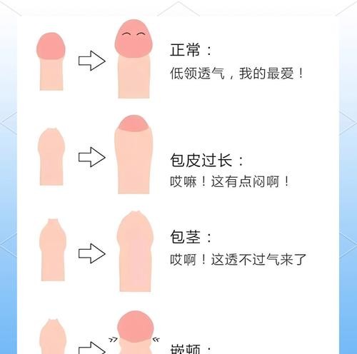 割包皮过长？这几种情况必须手术！