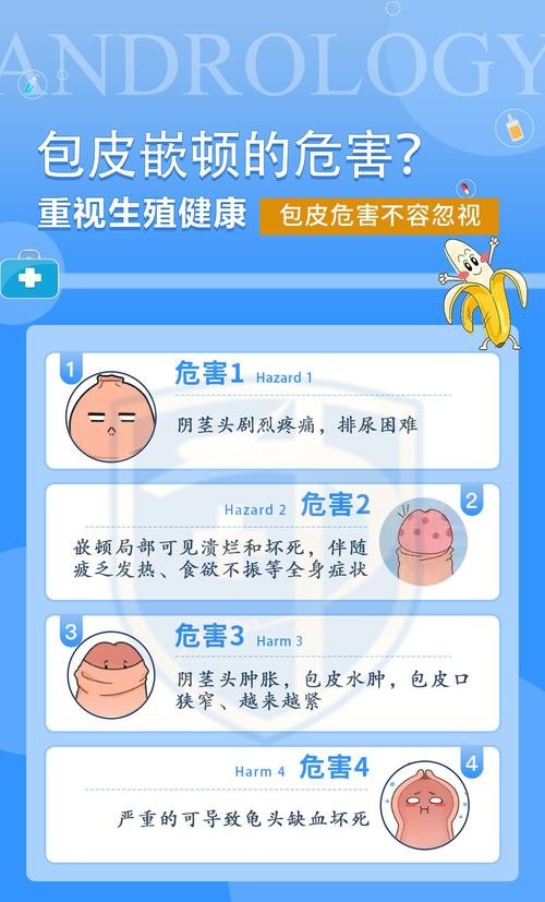 公立医院割包皮过长，这些细节你必须知道！