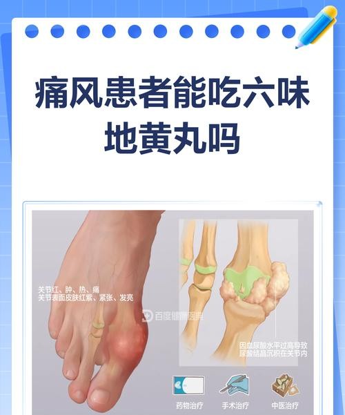 六味地黄丸痛风能吃吗？专家解答让你意想不到！