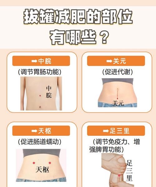 减肥拔罐的方法：轻松瘦身，告别赘肉！