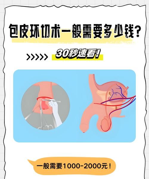 包皮过长一定要做手术么？医生揭秘真相！