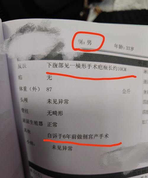 包皮过长中医诊断百度：中医专家教你如何正确识别与调理
