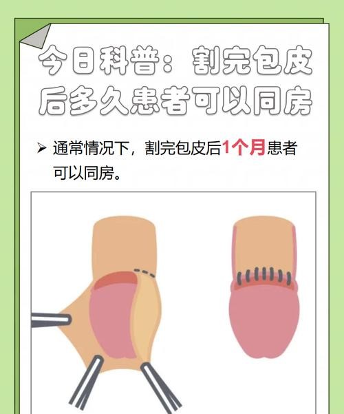 包皮过长什么时候能切除？医生建议这个年龄段最合适！