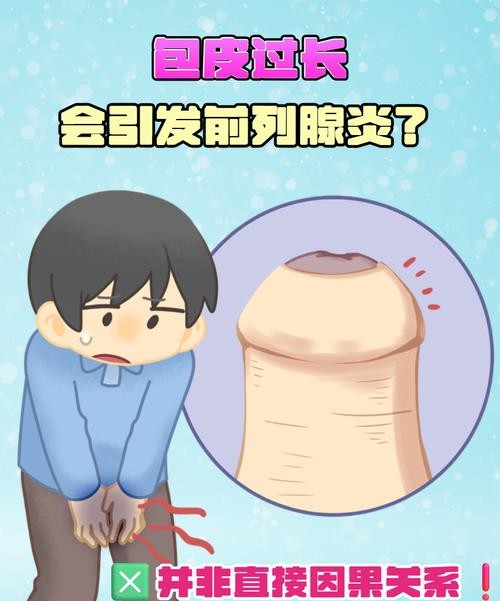包皮过长会前列腺炎么？医生揭秘真相，男性必看！