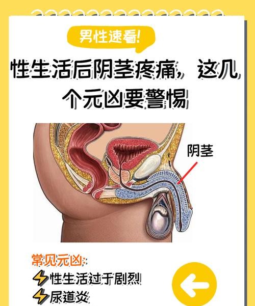 包皮过长射精龟头疼痛？这可能是身体在发出警告！