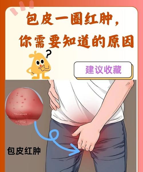 包皮过长性生活会发炎吗？医生揭秘惊人真相！