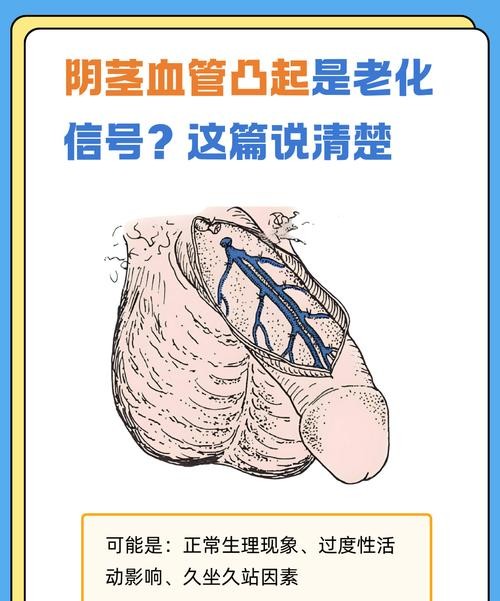 包皮过长毛细血管粗，这些症状你中招了吗？