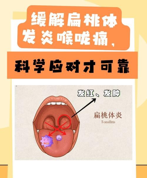 喉咙发炎拉肚子？这些症状背后隐藏的健康秘密！