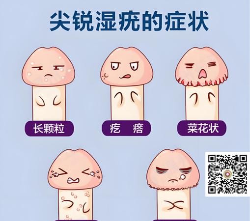 尖锐湿疣患者如何保护家人健康？