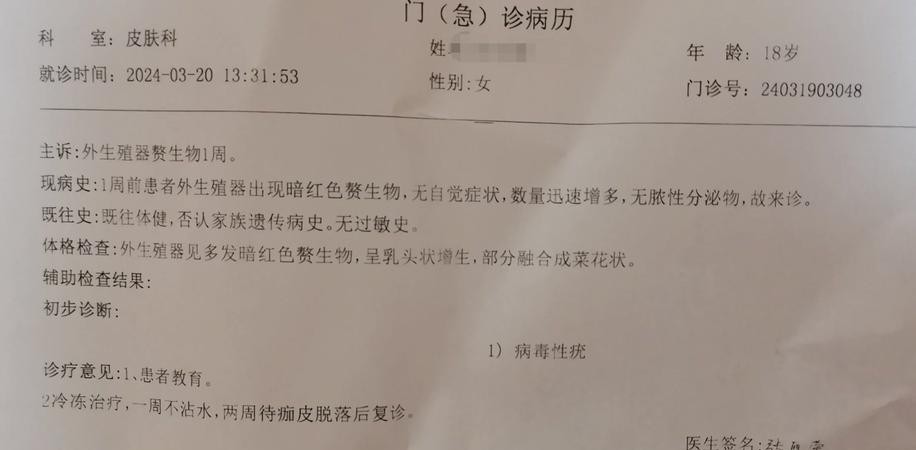 尖锐湿疣单方治疗，轻松告别烦恼！