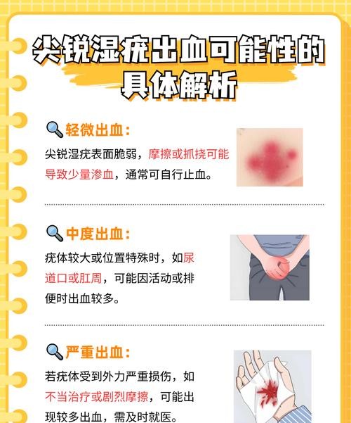 尖锐湿疣在血液吗？医生揭秘病毒传播真相