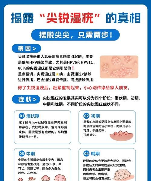 尖锐湿疣治不好？这些方法让你彻底告别困扰！