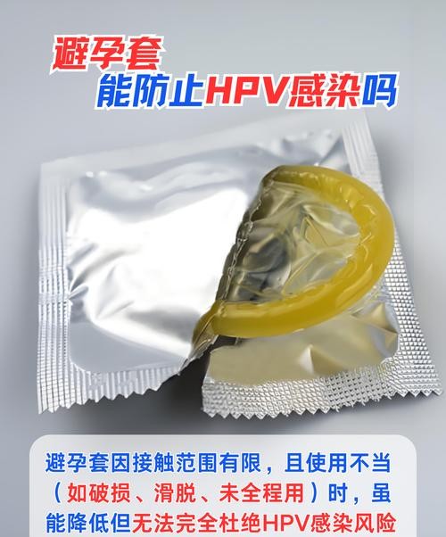 尖锐湿疣避孕套真的安全吗？医生揭秘惊人真相！