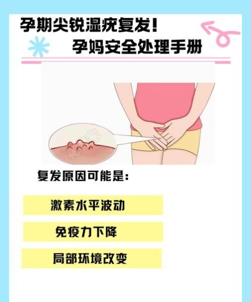 怀孕与尖锐湿疣复发：准妈妈必知的防护指南