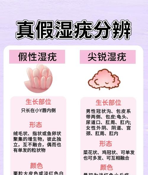 怀孕与尖锐湿疣复发：准妈妈必知的防护指南