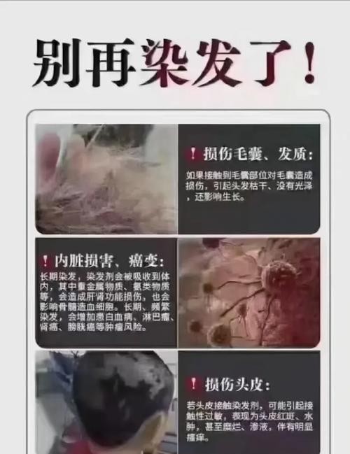 染发危害大吗？揭秘你不得不知的真相！