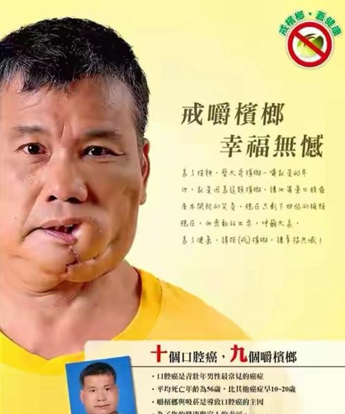 槟榔有危害吗？这些真相你必须知道！