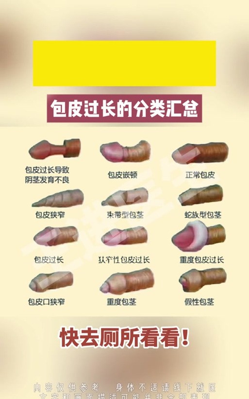 男性包皮过长是天生的吗？真相让你意想不到！