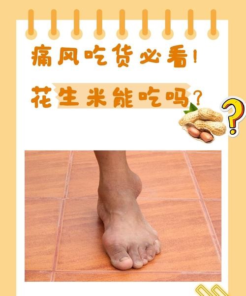 痛风吃花生米行吗？医生提醒：这3类人千万别碰！