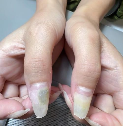 美甲危害大吗？揭秘你不可不知的惊人真相！