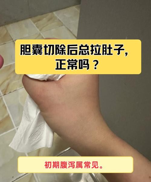 胆囊切除后拉肚子？这4个方法帮你轻松应对！