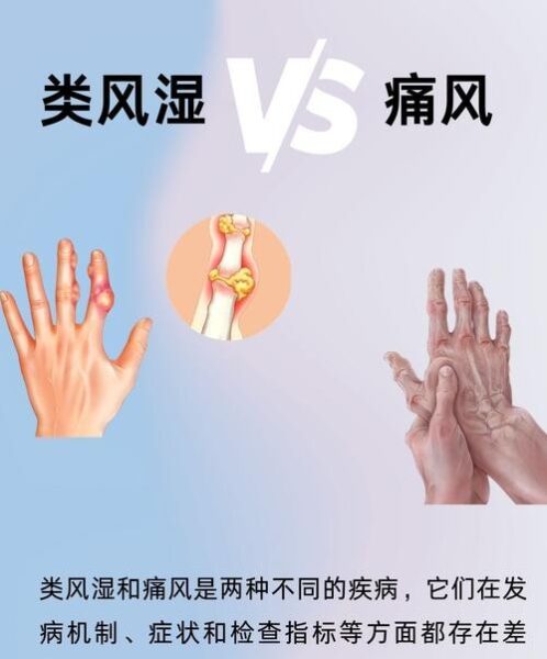 风湿和痛风到底有什么不同？别再傻傻分不清了！