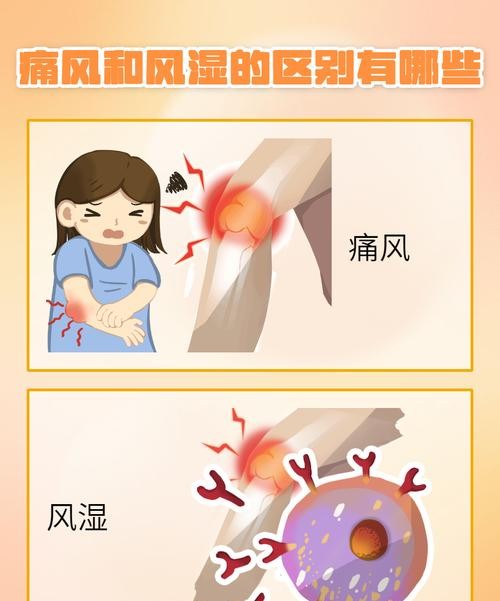 风湿和痛风到底有什么不同？别再傻傻分不清了！
